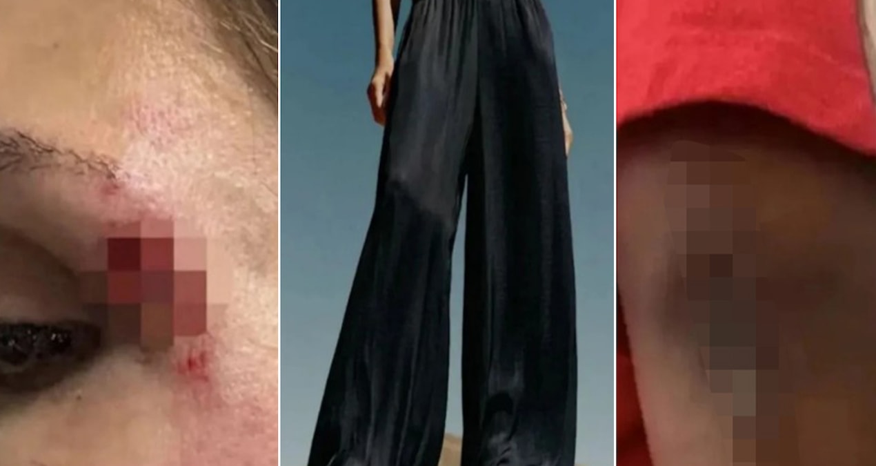 Moda akimi kabusa donustu bu pantolonu giyen yere dusuyor jmZx6Efe